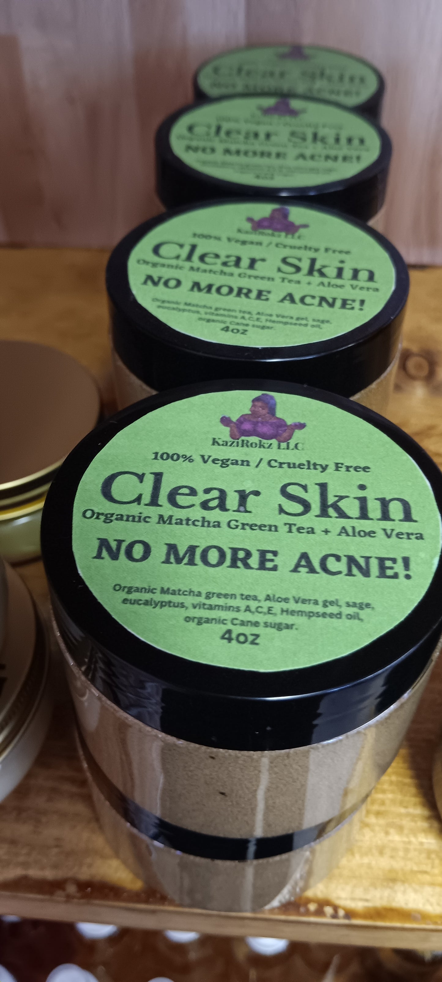 Organic Matcha Green Tea + Aloe Vera Acne Treatment/ Clear Skin Treatment (100% Vegan/CrueltyFree) 4oz