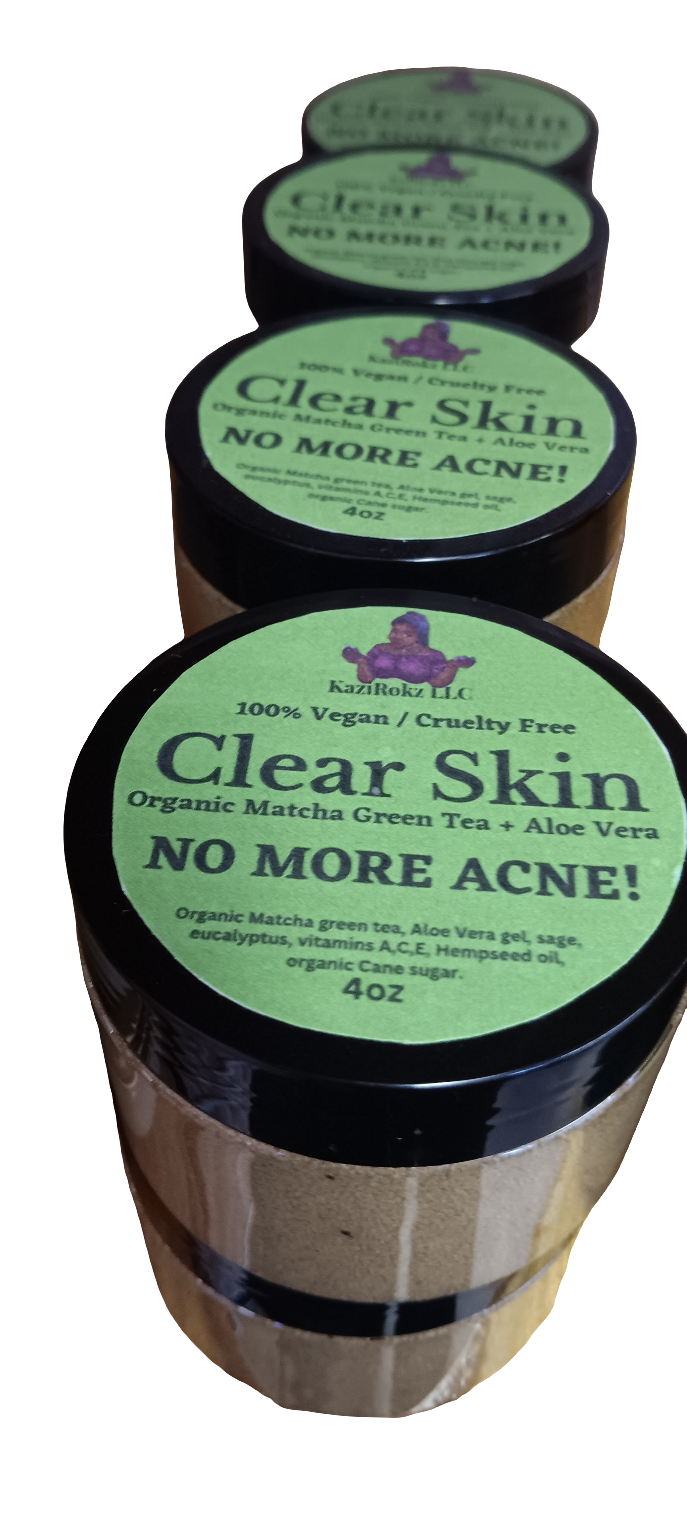 Organic Matcha Green Tea + Aloe Vera Acne Treatment/ Clear Skin Treatment (100% Vegan/CrueltyFree) 4oz