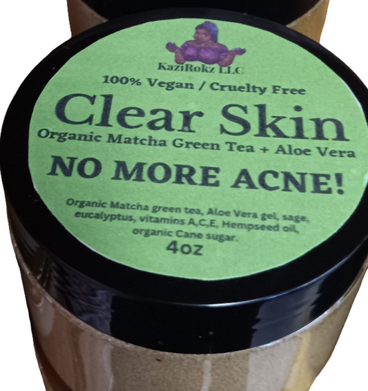 Organic Matcha Green Tea + Aloe Vera Acne Treatment/ Clear Skin Treatment (100% Vegan/CrueltyFree) 4oz