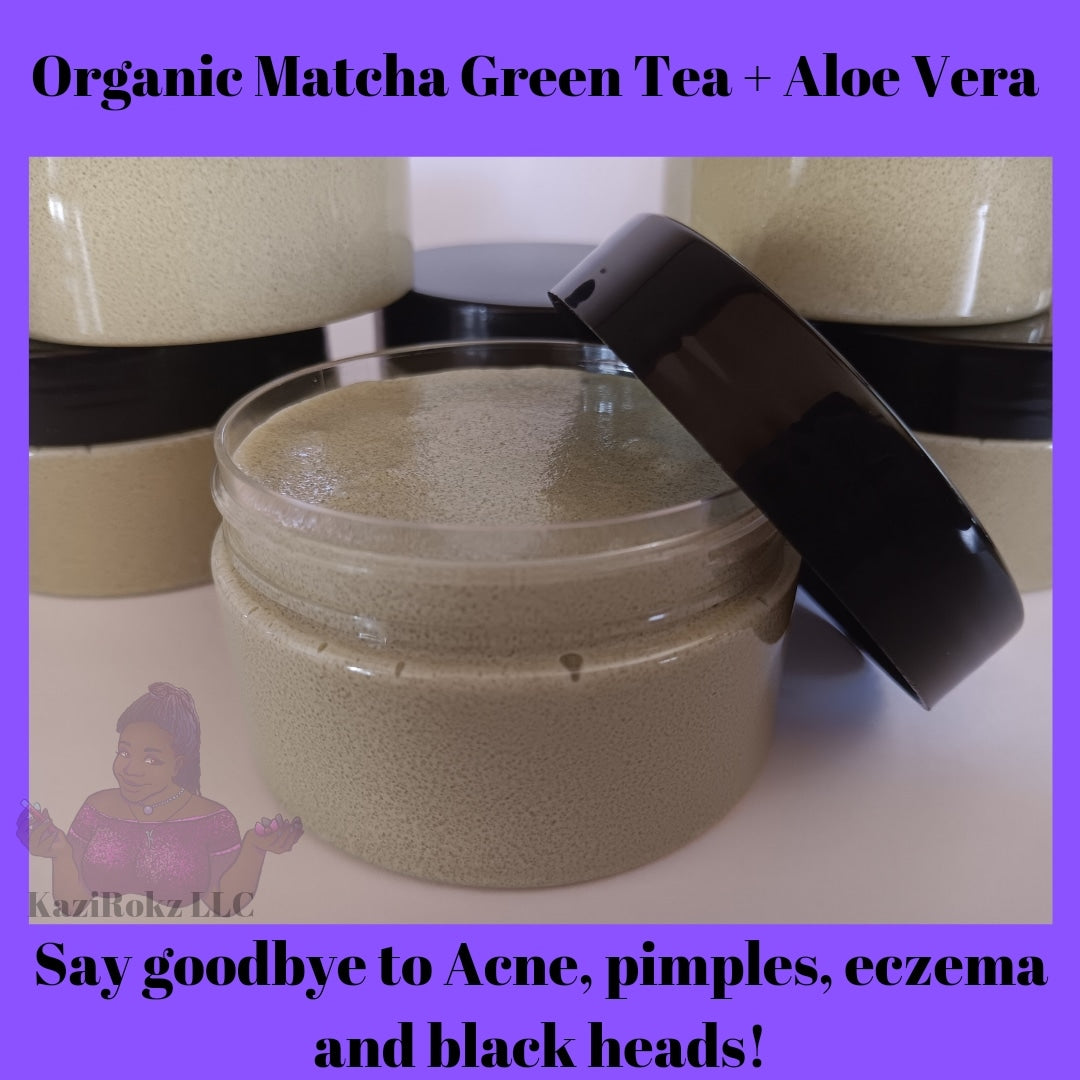 Organic Matcha Green Tea + Aloe Vera Acne Treatment/ Clear Skin Treatment (100% Vegan/CrueltyFree) 4oz